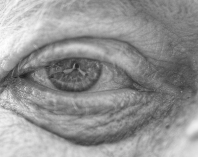 ageing eye loses transparency