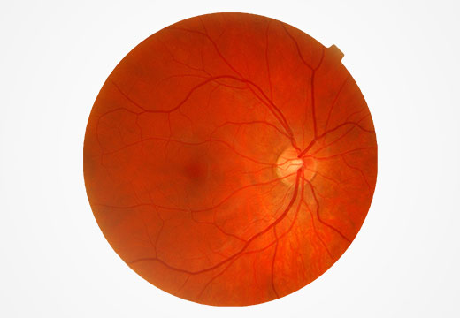 retina-scan